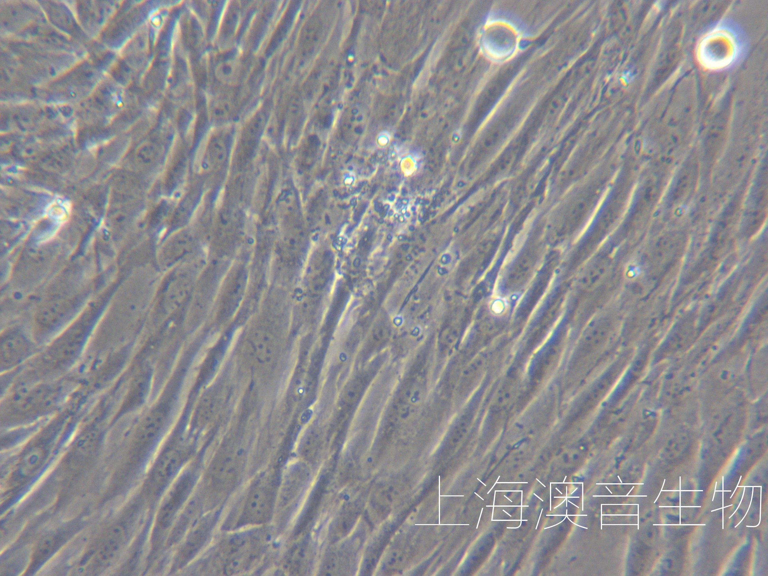 人肺血管周细胞-永-240803-1