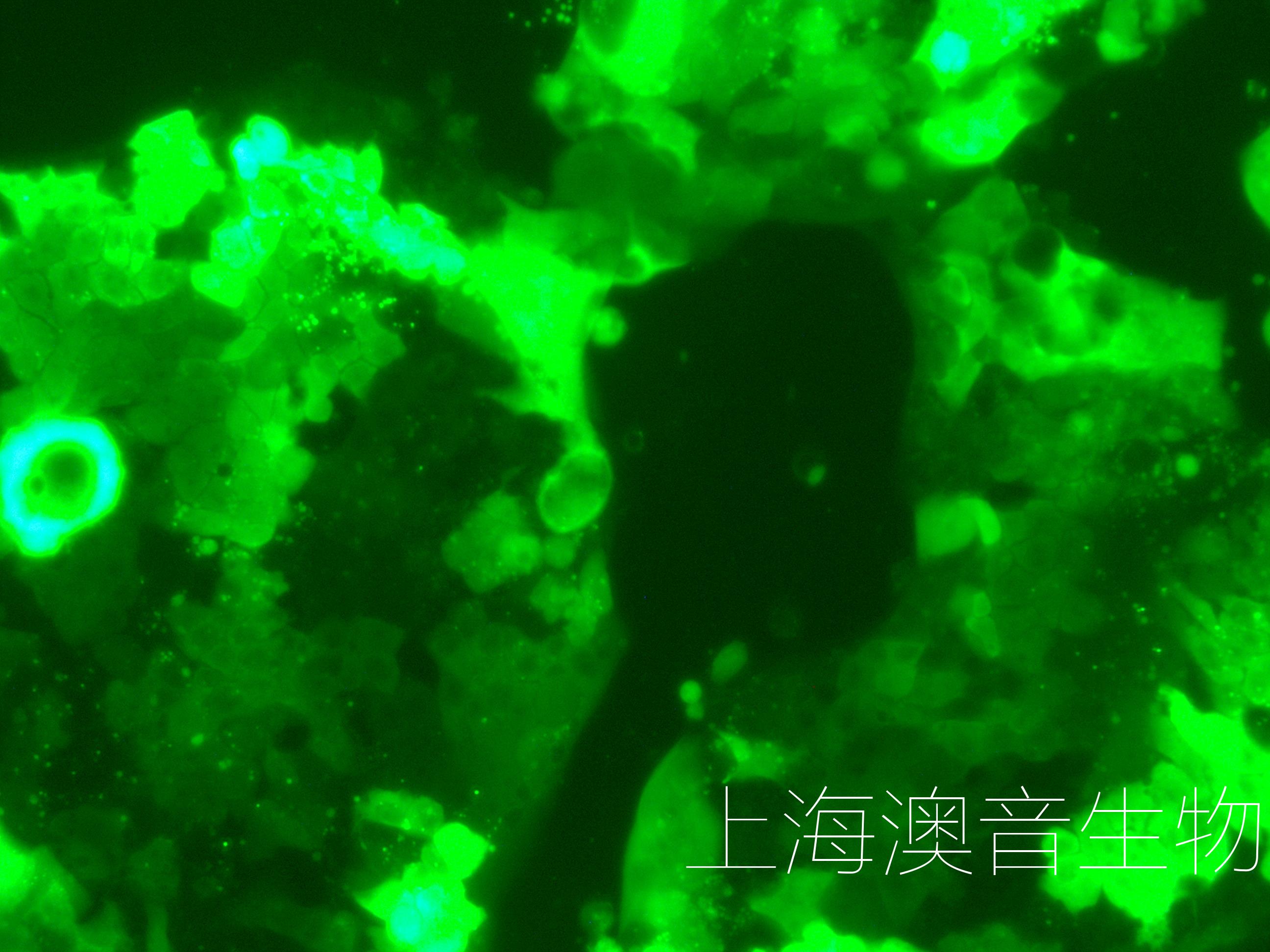 N87-LUC-GFP-240815