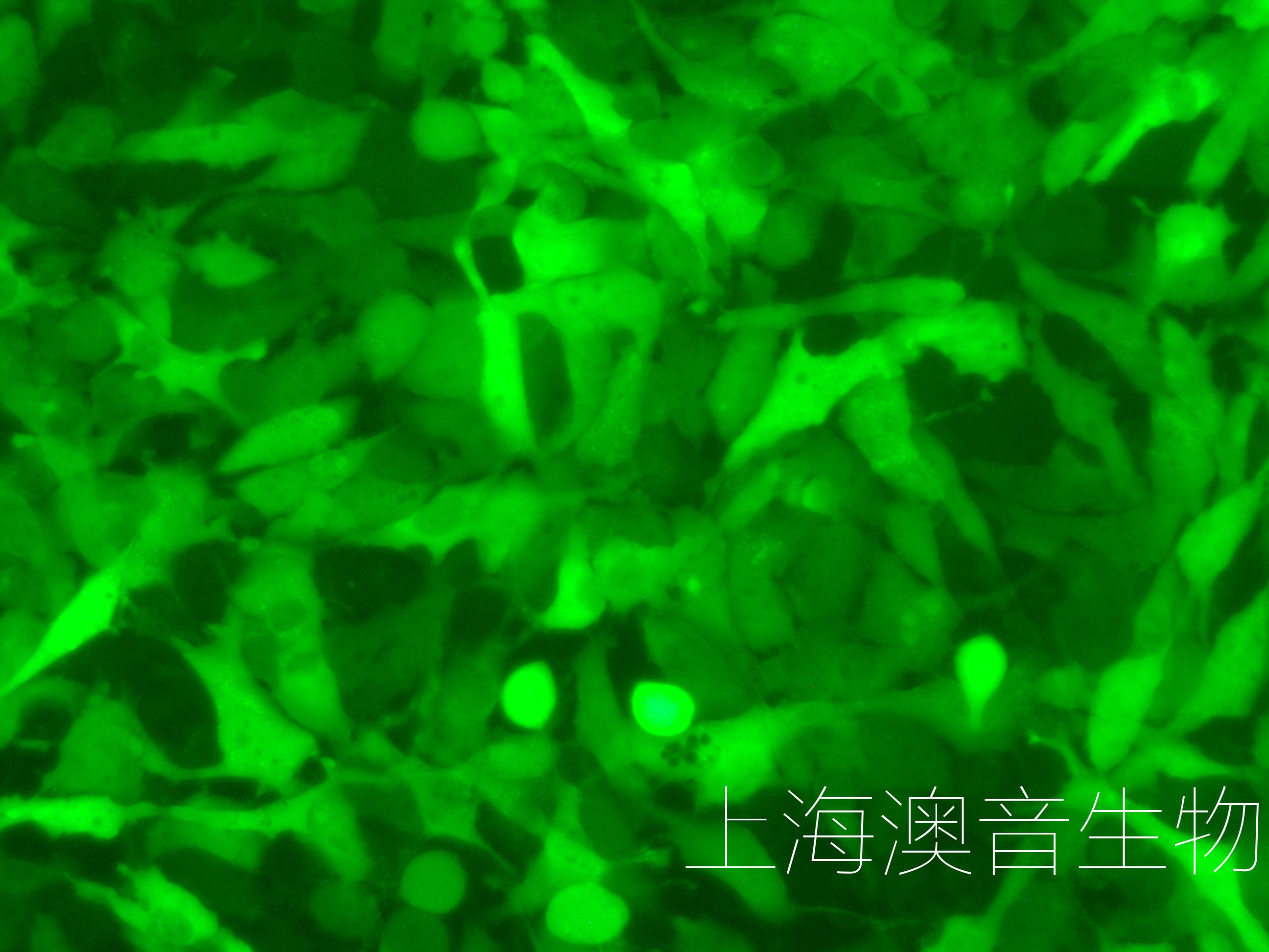 HEY-LUC-GFP-240912-4