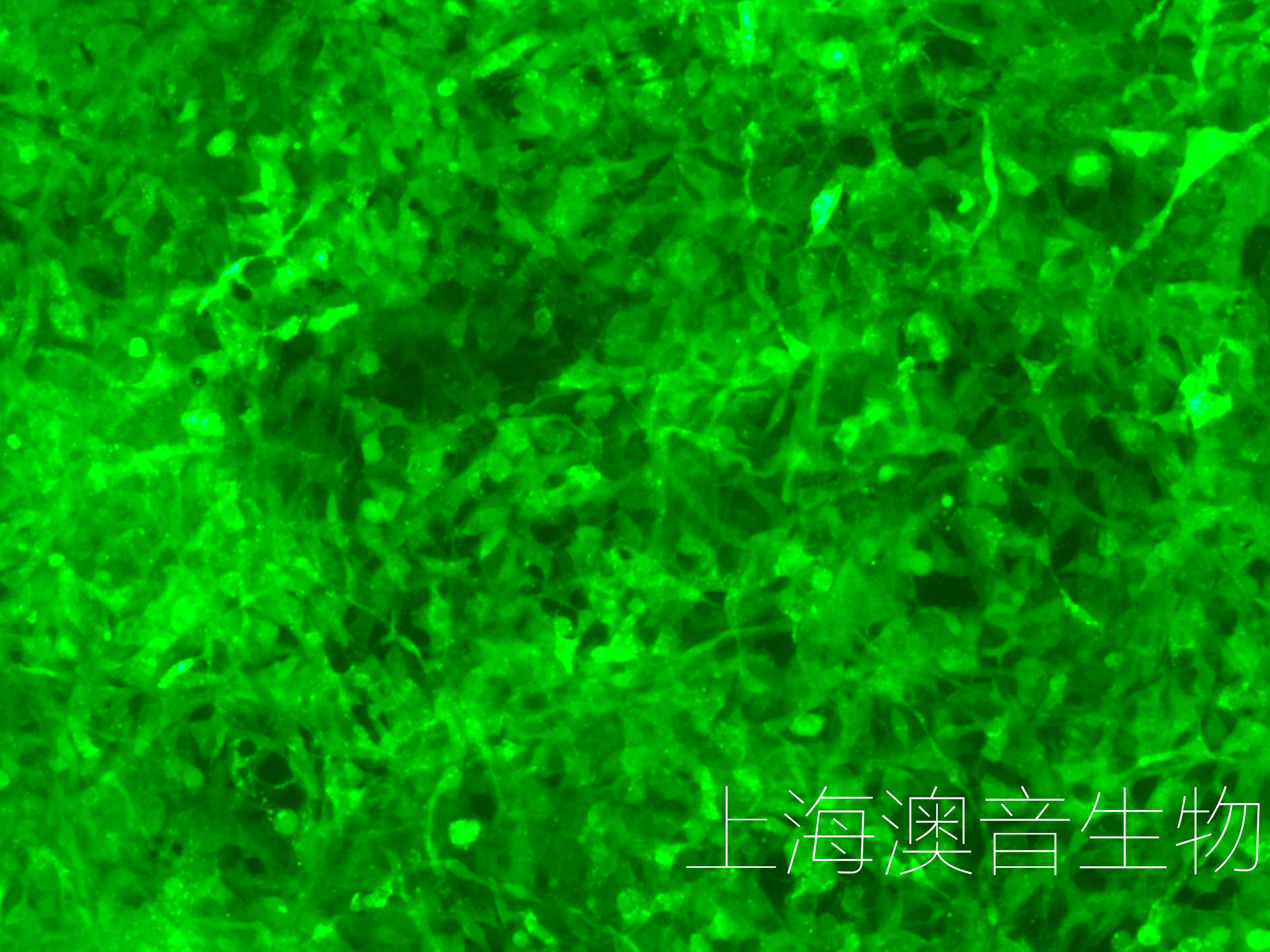 HEY-LUC-GFP-240916