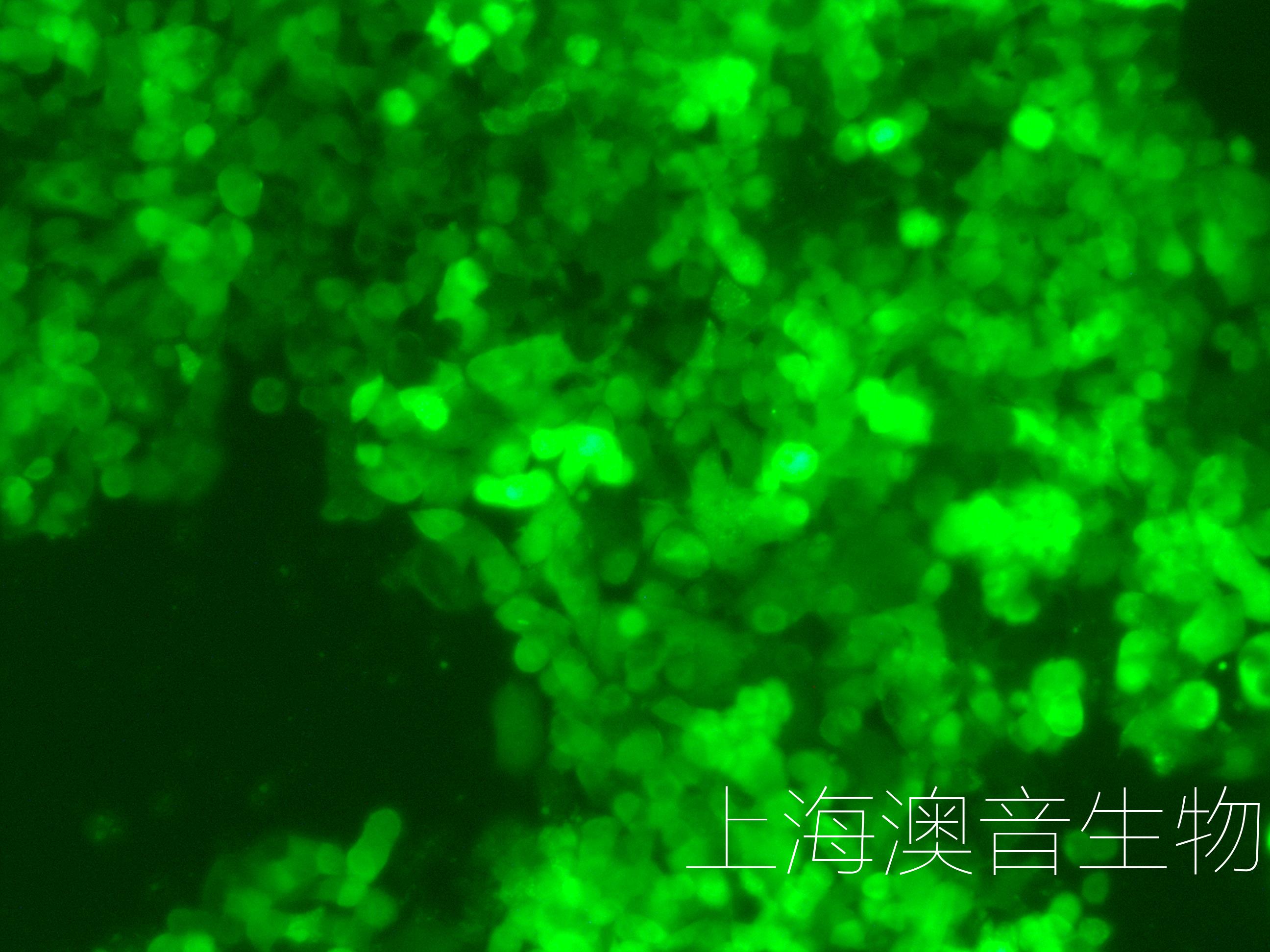 SW48-LUC-GFP-240916-1