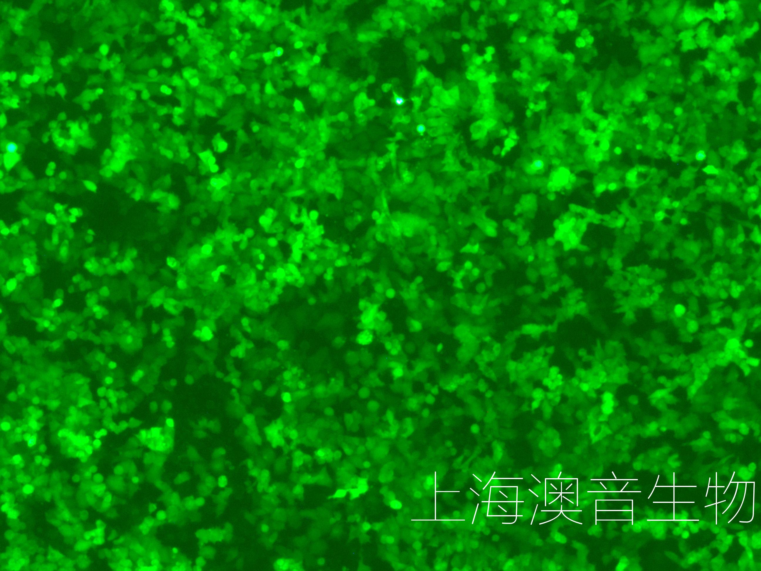 LN18-LUC-GFP-241014-1