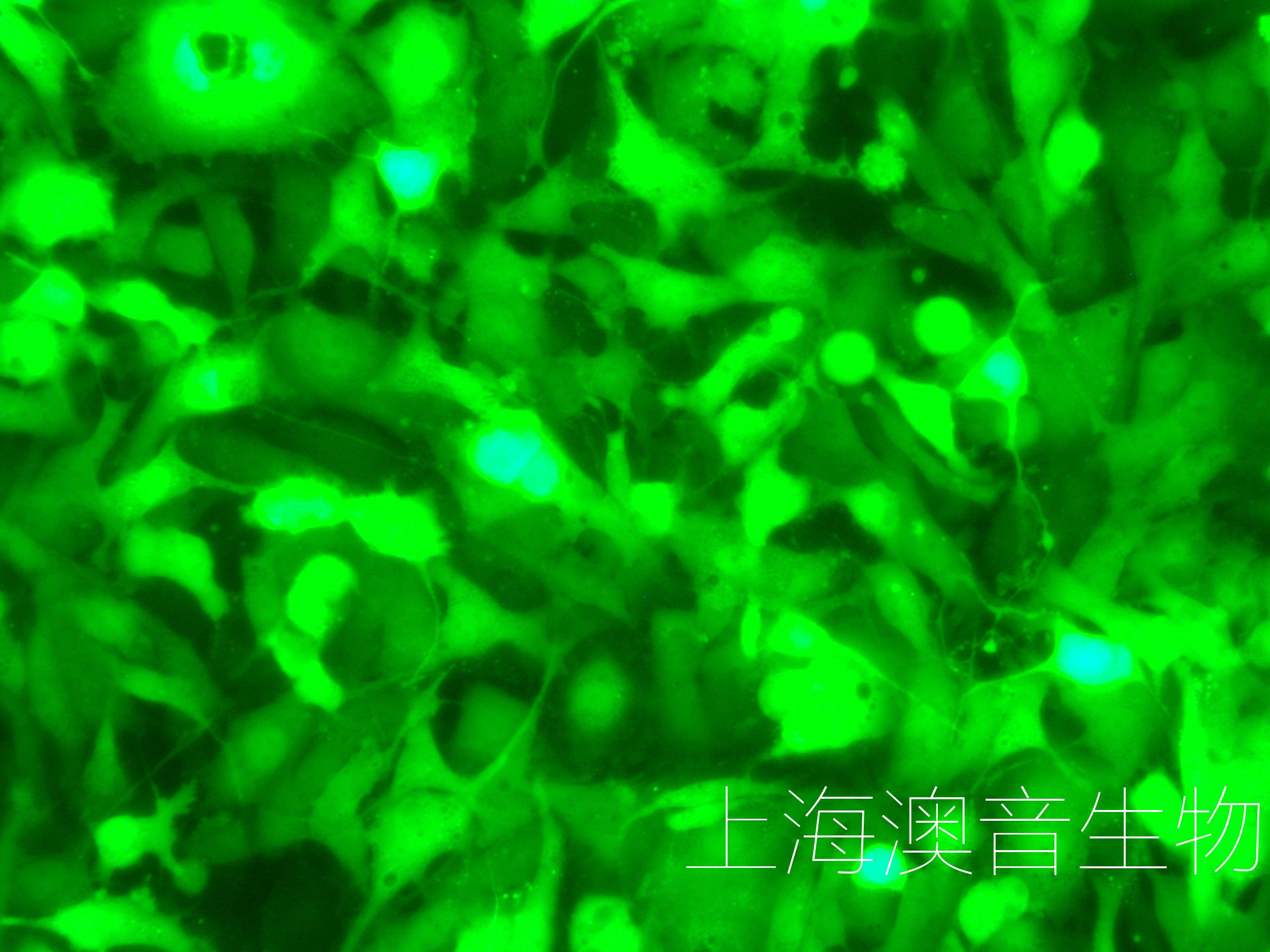 LX2-LUC-GFP-241024-1