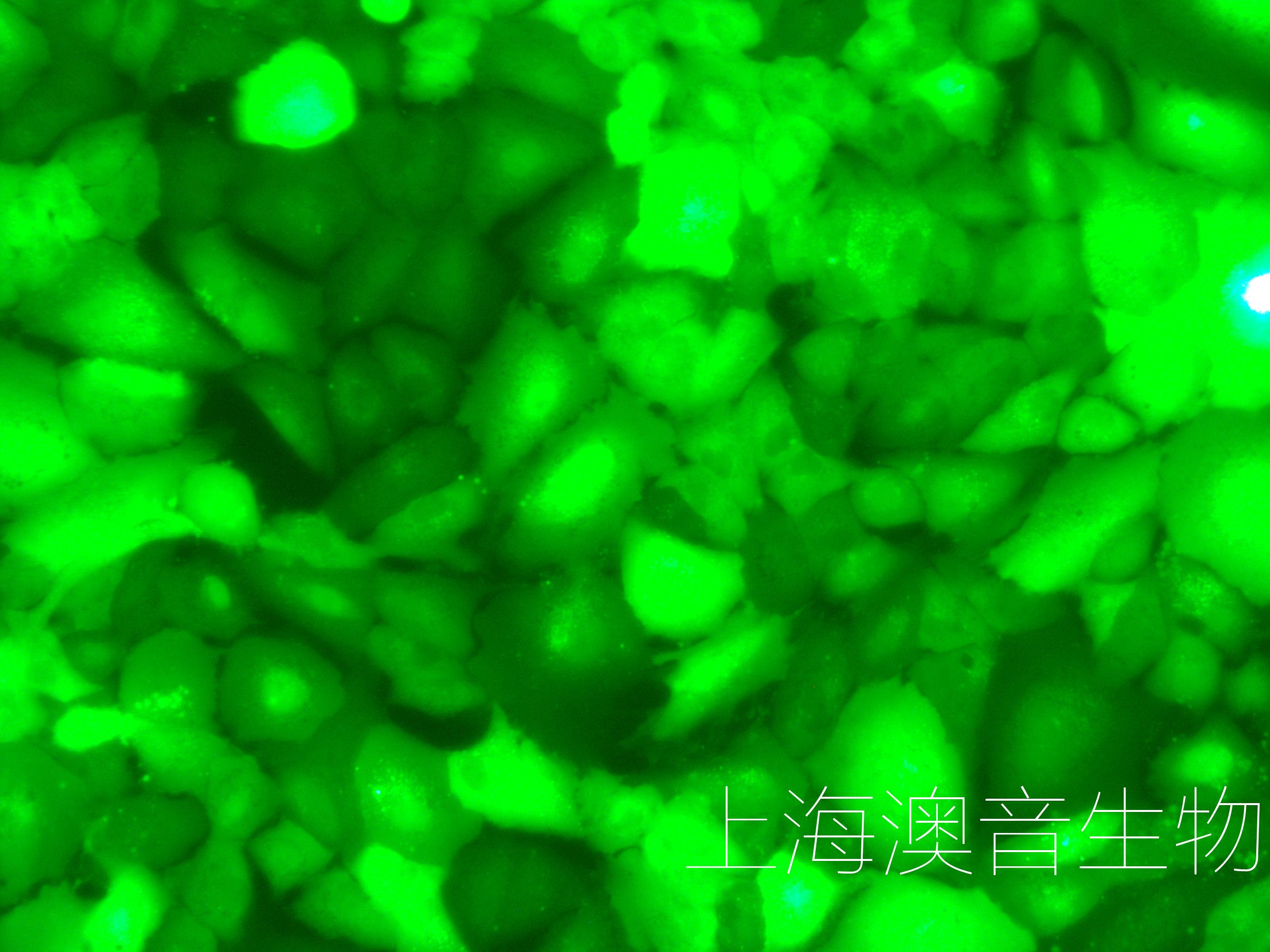 A549-GFP-241120-1