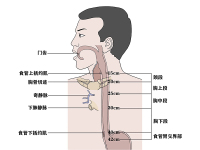 食道癌