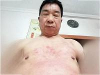 左心室肿大