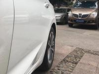 有前侧凹陷修复后