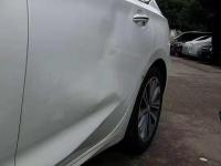 右前侧凹陷修复前